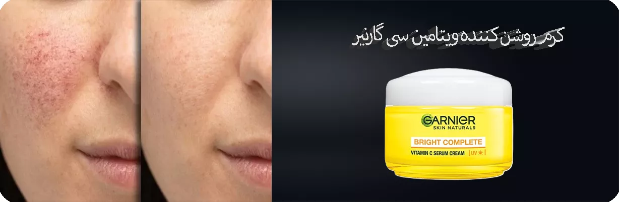 کرم روشن کننده ویتامین سی گارنیر حاوی عصاره لیمو | سان ماری
