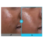 نتایج استفاده از سرم رتینول آبی نامبوزین اصل و اورجینال | سان ماری